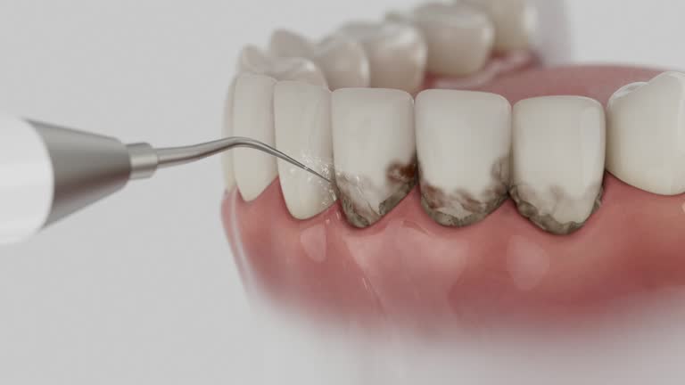 Reliable Dental contractor in Sarasota Springs, FL by Dentist Open Now